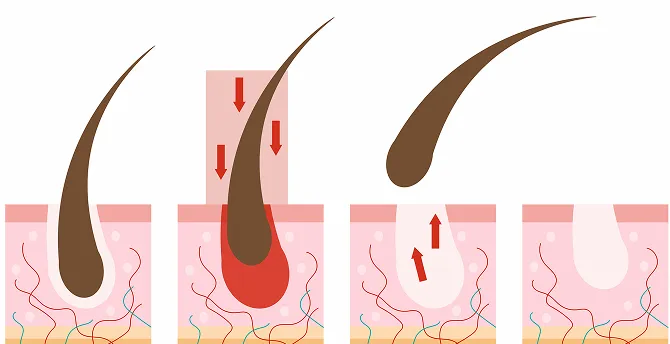 薄毛・抜け毛、3人に1人が気にしています…